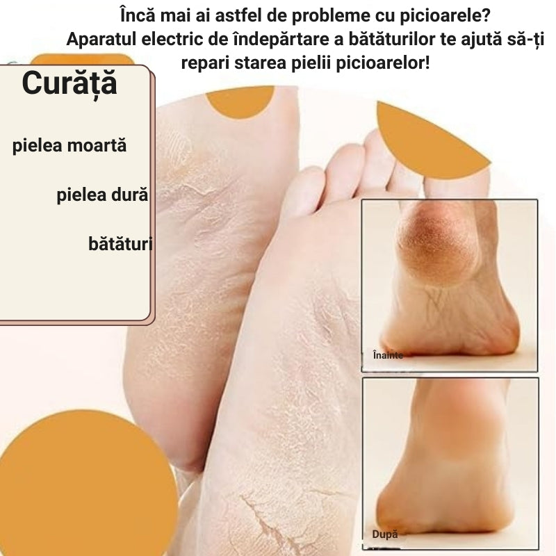 PILĂ ELECTRICĂ PENTRU CĂLCÂIE