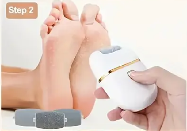 3 REZERVE PILĂ CĂLCÂIE